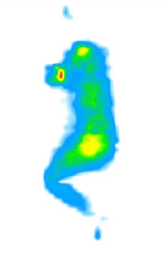 Pressure map for someone sleeping on the Saatva Classic on their side