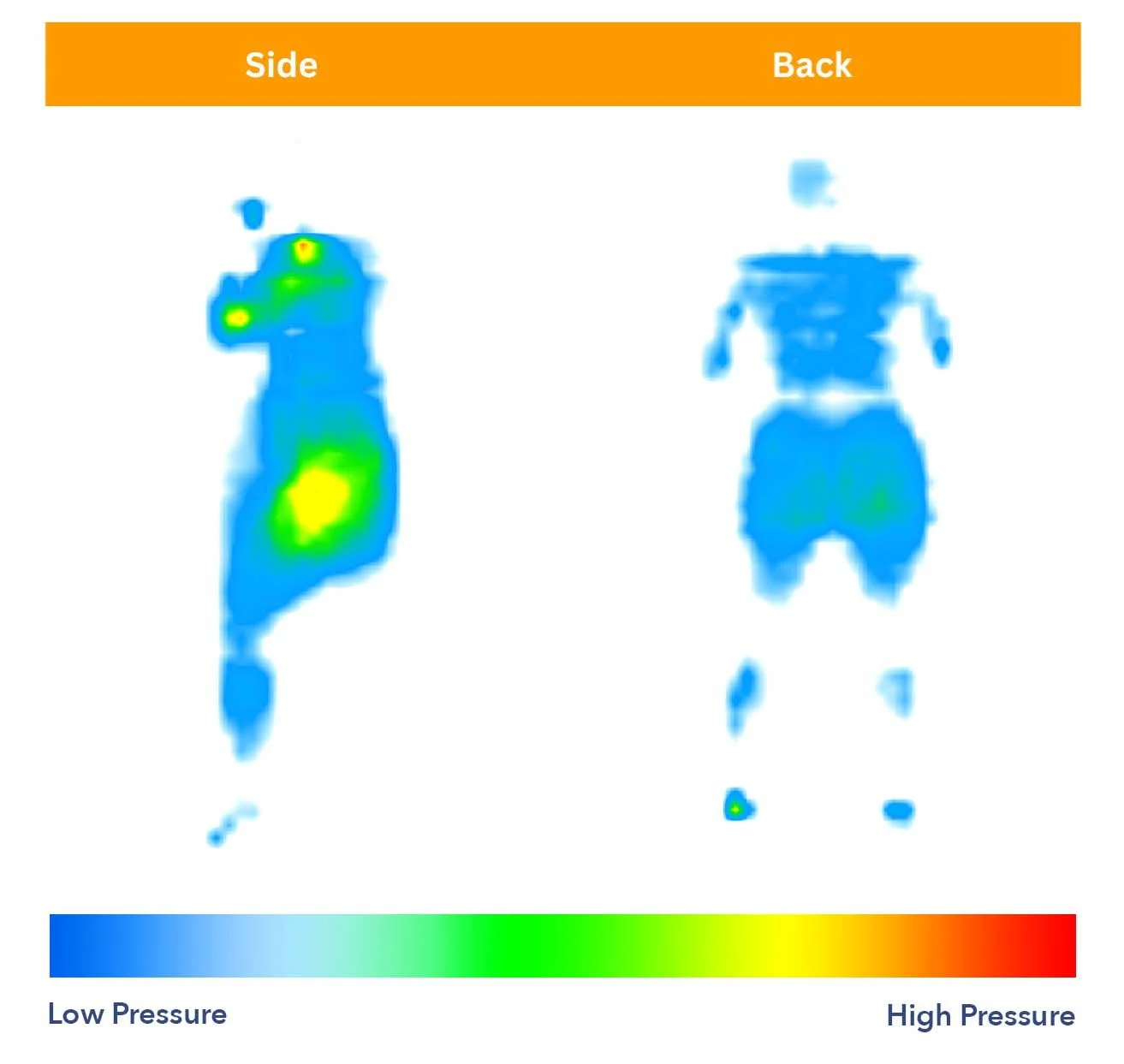 My Brooklyn Bedding Aurora Luxe Mattress Review for 2026 9 Brooklyn Bedding Aurora Luxe Pressure Map