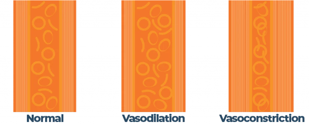 Illustration of Normal Artery, Vasodilation and Vasoconstriction